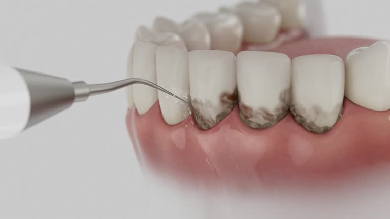 Trusted Dental Crowns And Bridges service in Johnstown, PA - Dentist Open Now